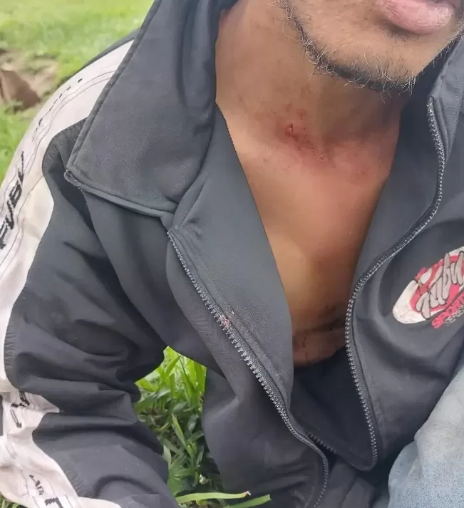 Homem sofre Acidente ao Cair de Bicicleta e acaba Perfurado por Vergalhão na Av. 30 de Junho 