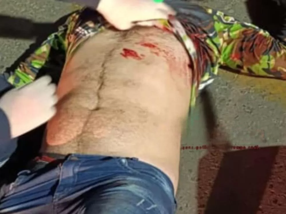 Tiroteio no Trânsito: Motociclista é baleado por Policial após conflito no trânsito