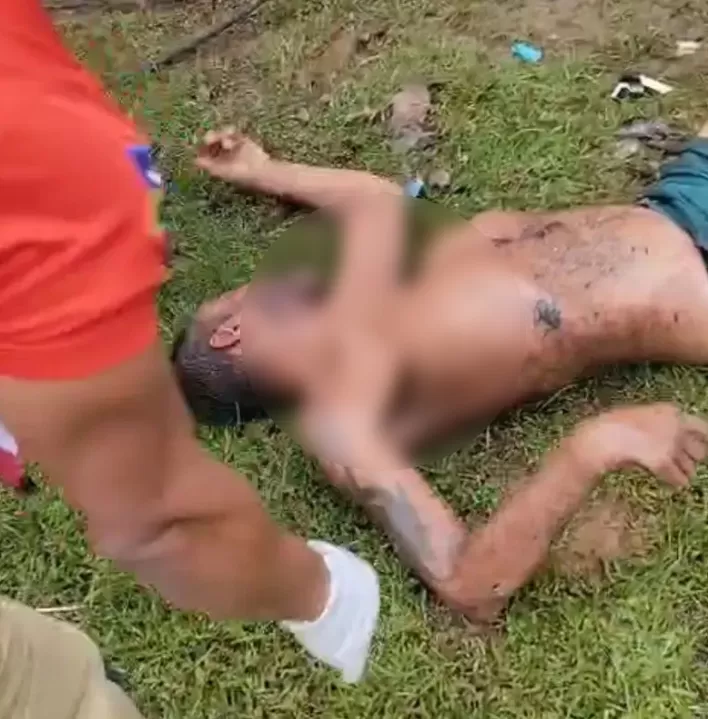 Incêndio em Container Frequentado por Usuários de Drogas Deixa Um Ferido em Ji-Paraná