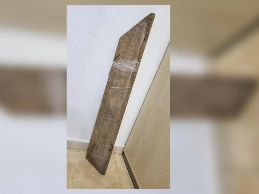 Mulher é agredida brutalmente pelo ex-companheiro em Cacoal