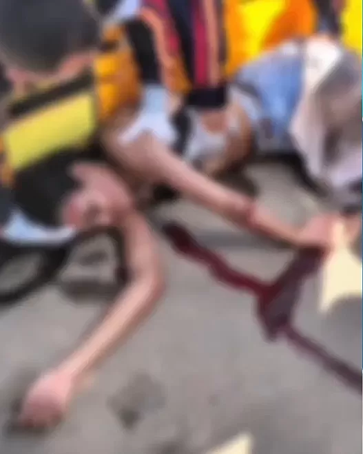 Jovem Motociclista Colide com Caminhão Baú da Gazin em Ji-Paraná acaba Transferida em Estado Crítico para Cacoal