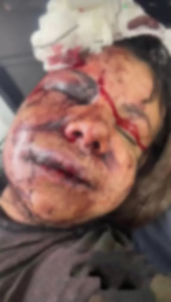 Vídeo Brutal no RN: Ex-jogador da Seleção Brasileira de Basquete é Preso Após Espancar Namorada com Mais de 60 Socos