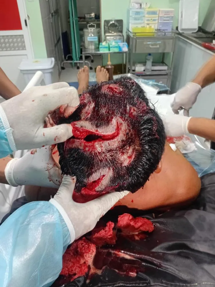 Vídeo: Cacique é Atacado por Onça e Salvo por Helicóptero em Comunidade Indígena – Veja o Vídeo