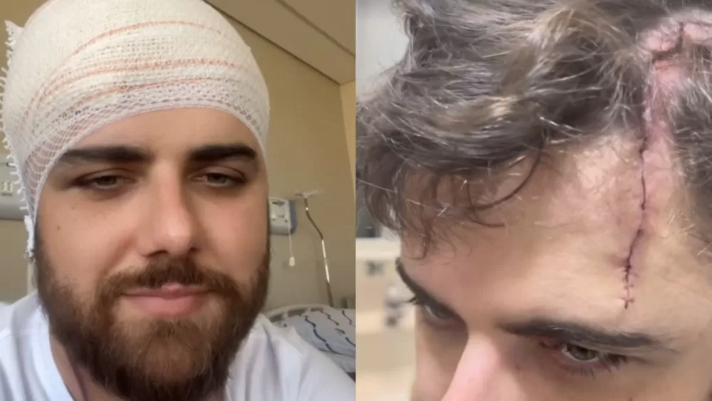 Zé Neto, da dupla com Cristiano, revela detalhes de acidente e exibe ferimento na cabeça
