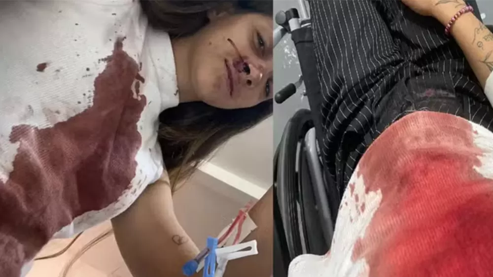 Em Ji-Paraná Jovem é violentamente agredida aos socos por esbarrar em homem