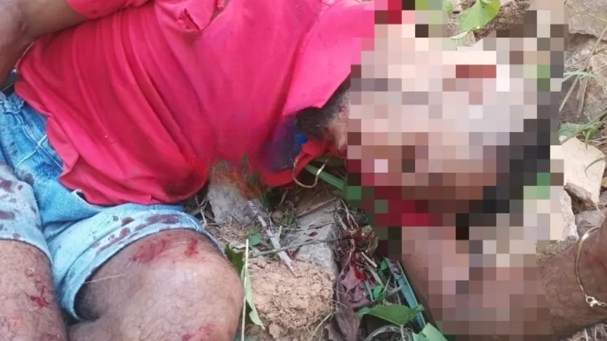 Jovem é Encontrado Ensanguentado Próximo ao Anel Viário na BR-364