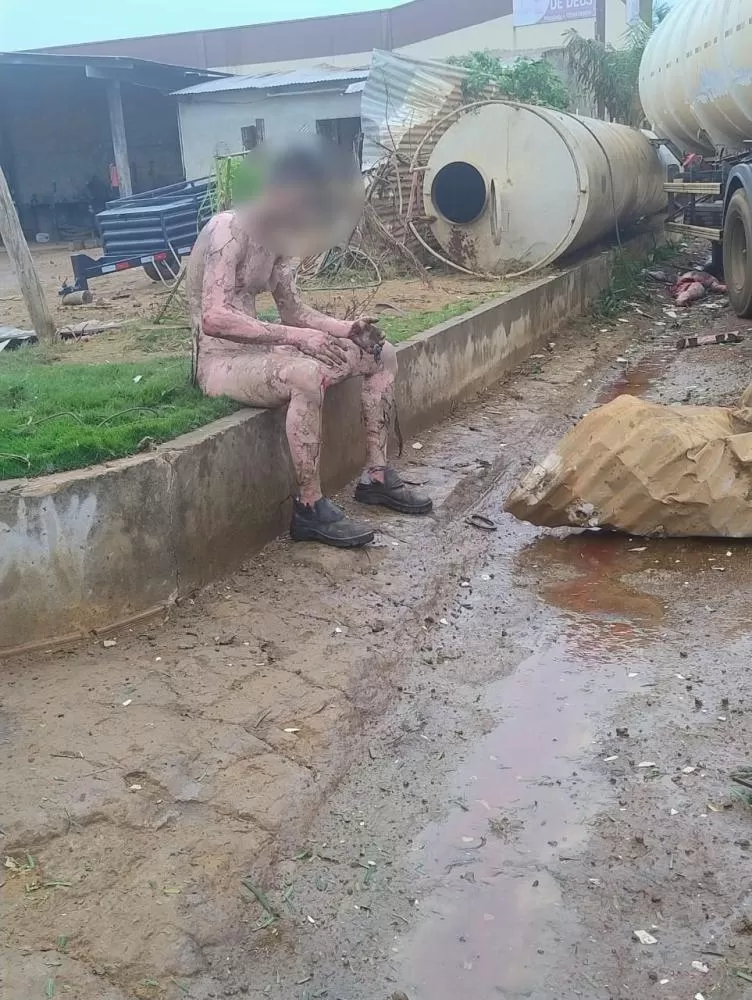 Urgente! Em Rondônia Tanque de Caminhão Explode e Dilacera Adolescente de 16 Anos