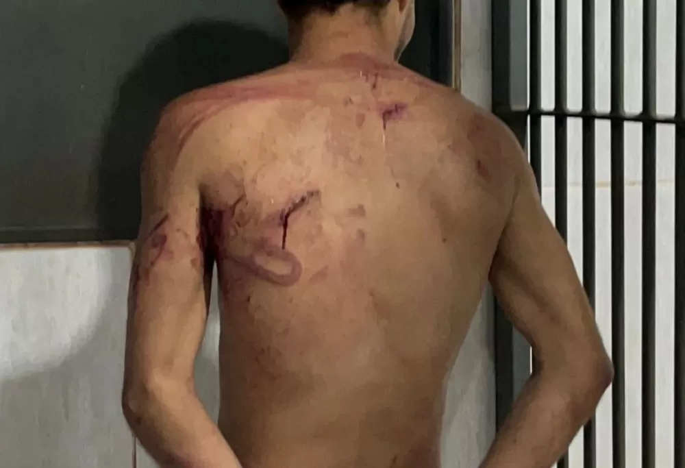 Barbeiro é Atacado a Facadas em Porto Velho e Criminoso acaba Espancado por Populares