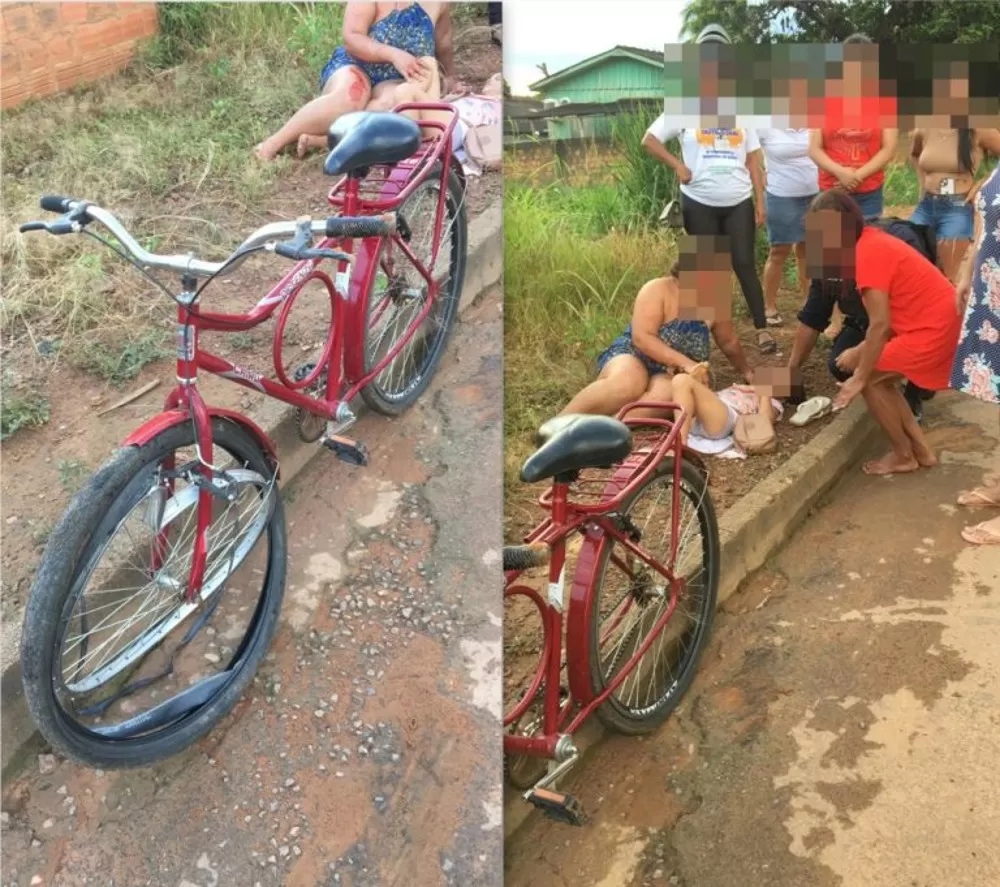 Acidente de Bicicleta na Rua Monteiro Lobato no Setor 06 Deixa Mãe e Filha Feridas Após Colisão com Muro