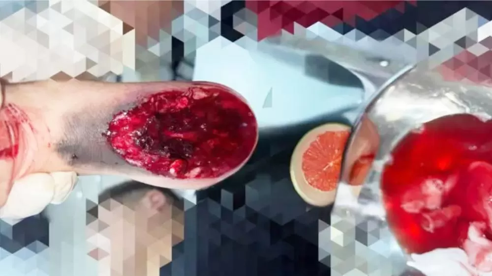 Menor de Idade Fica Gravemente Ferido em Disparo Acidental ao Manusear Espingarda